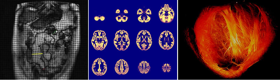 EPSRC Centre for Doctoral Training in Intelligent, Integrated Imaging In Healthcare (i4health)