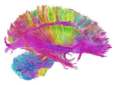Fully funded (no tuition) PhD program in psychiatric, translational research and basic Neuroscience with the option for a residency track for medical doctors. Fully funded (no tuition) PhD program in psychiatric, translational research and basic Neuroscience with the option for a residency track for medical doctors.