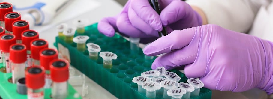 Close up of gloved hands handling test tubes in trays